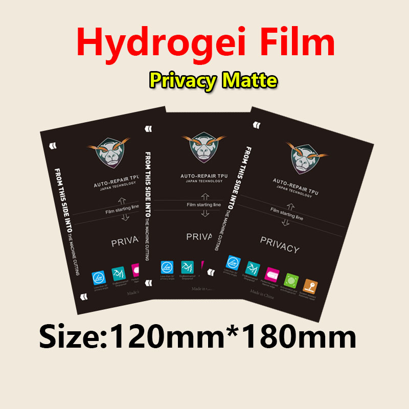 5/25/50/100PCS Privatsphäre Ma – Screen Printing Squeegee Bewertung und Preis